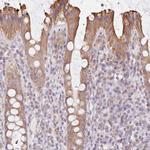 FAM208B Polyclonal Antibody