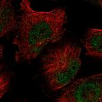 FAM208B Antibody in Immunocytochemistry (ICC/IF)