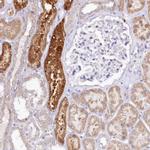 PTER Polyclonal Antibody