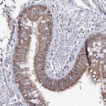 LRRC14B Antibody in Immunohistochemistry (Paraffin) (IHC (P))