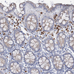 SIAE Antibody in Immunohistochemistry (Paraffin) (IHC (P))