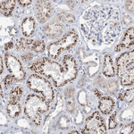 SIAE Antibody in Immunohistochemistry (Paraffin) (IHC (P))