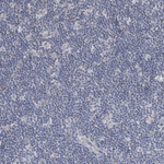 SIAE Polyclonal Antibody