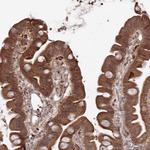 ATRNL1 Antibody in Immunohistochemistry (Paraffin) (IHC (P))
