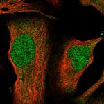 GBE1 Polyclonal Antibody