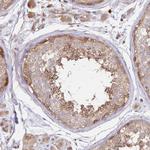 GBE1 Antibody in Immunohistochemistry (Paraffin) (IHC (P))