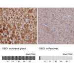 GBE1 Antibody in Immunohistochemistry (IHC)