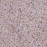 GBE1 Antibody in Immunohistochemistry (IHC)