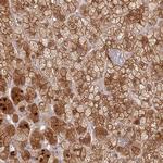 GBE1 Antibody in Immunohistochemistry (IHC)