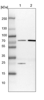GBE1 Antibody in Western Blot (WB)