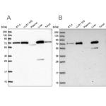 GBE1 Antibody in Western Blot (WB)
