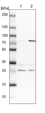 GBE1 Antibody in Western Blot (WB)