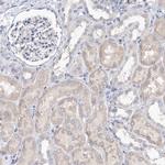 KIAA1109 Antibody in Immunohistochemistry (Paraffin) (IHC (P))