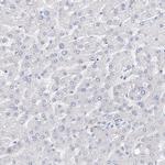 KIAA1109 Antibody in Immunohistochemistry (Paraffin) (IHC (P))