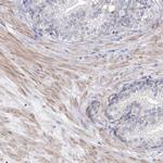 KIAA1109 Antibody in Immunohistochemistry (Paraffin) (IHC (P))