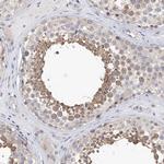 KIAA1109 Antibody in Immunohistochemistry (Paraffin) (IHC (P))
