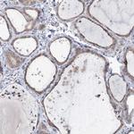 KIAA1109 Antibody in Immunohistochemistry (Paraffin) (IHC (P))