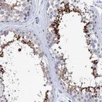 SPATA7 Antibody in Immunohistochemistry (Paraffin) (IHC (P))