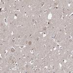 WDR44 Antibody in Immunohistochemistry (Paraffin) (IHC (P))