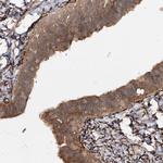 WDR44 Antibody in Immunohistochemistry (Paraffin) (IHC (P))