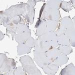 WDR44 Antibody in Immunohistochemistry (Paraffin) (IHC (P))