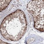 WDR44 Polyclonal Antibody