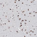 KIAA0930 Antibody in Immunohistochemistry (Paraffin) (IHC (P))