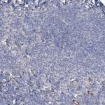 ANGPTL3 Polyclonal Antibody