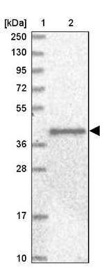 ANGPTL3 Antibody in Western Blot (WB)
