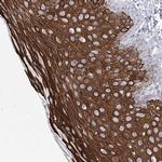 Girdin Polyclonal Antibody