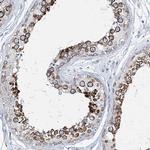 Girdin Antibody in Immunohistochemistry (IHC)