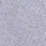 Girdin Antibody in Immunohistochemistry (IHC)