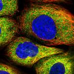 FAM13A Antibody in Immunocytochemistry (ICC/IF)