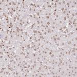 FAM13A Antibody in Immunohistochemistry (Paraffin) (IHC (P))