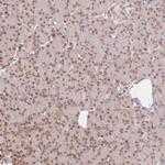 FAM13A Antibody in Immunohistochemistry (Paraffin) (IHC (P))