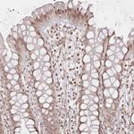 FAM13A Antibody in Immunohistochemistry (Paraffin) (IHC (P))