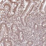 FAM13A Antibody in Immunohistochemistry (IHC)