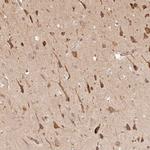 FAM13A Antibody in Immunohistochemistry (Paraffin) (IHC (P))