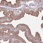 FAM13A Antibody in Immunohistochemistry (Paraffin) (IHC (P))