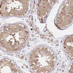 FAM13A Antibody in Immunohistochemistry (Paraffin) (IHC (P))