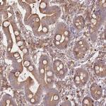 FAM13A Antibody in Immunohistochemistry (IHC)