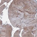 MTRR Polyclonal Antibody