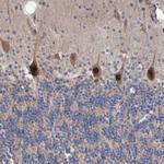 PPP2R2B Polyclonal Antibody