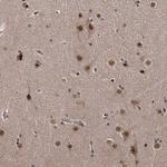 TSHZ2 Antibody in Immunohistochemistry (Paraffin) (IHC (P))