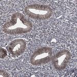 TSHZ2 Antibody in Immunohistochemistry (Paraffin) (IHC (P))