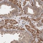 TSHZ2 Antibody in Immunohistochemistry (Paraffin) (IHC (P))