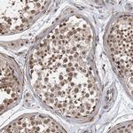 TSHZ2 Antibody in Immunohistochemistry (Paraffin) (IHC (P))
