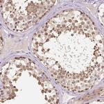 C10orf67 Polyclonal Antibody