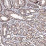 SH3TC1 Polyclonal Antibody