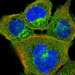 HIP1R Polyclonal Antibody